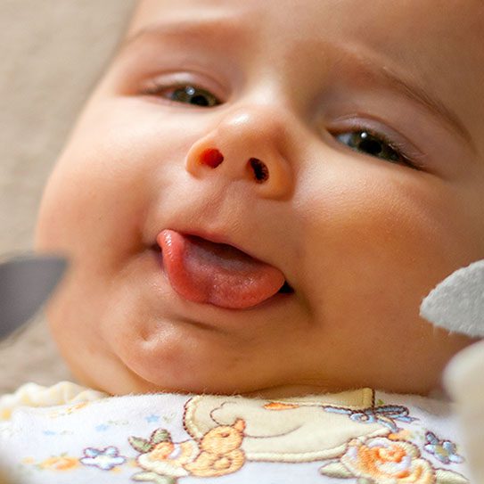 Lip and Tongue Ties: A Guide for Parents 1 Torrance